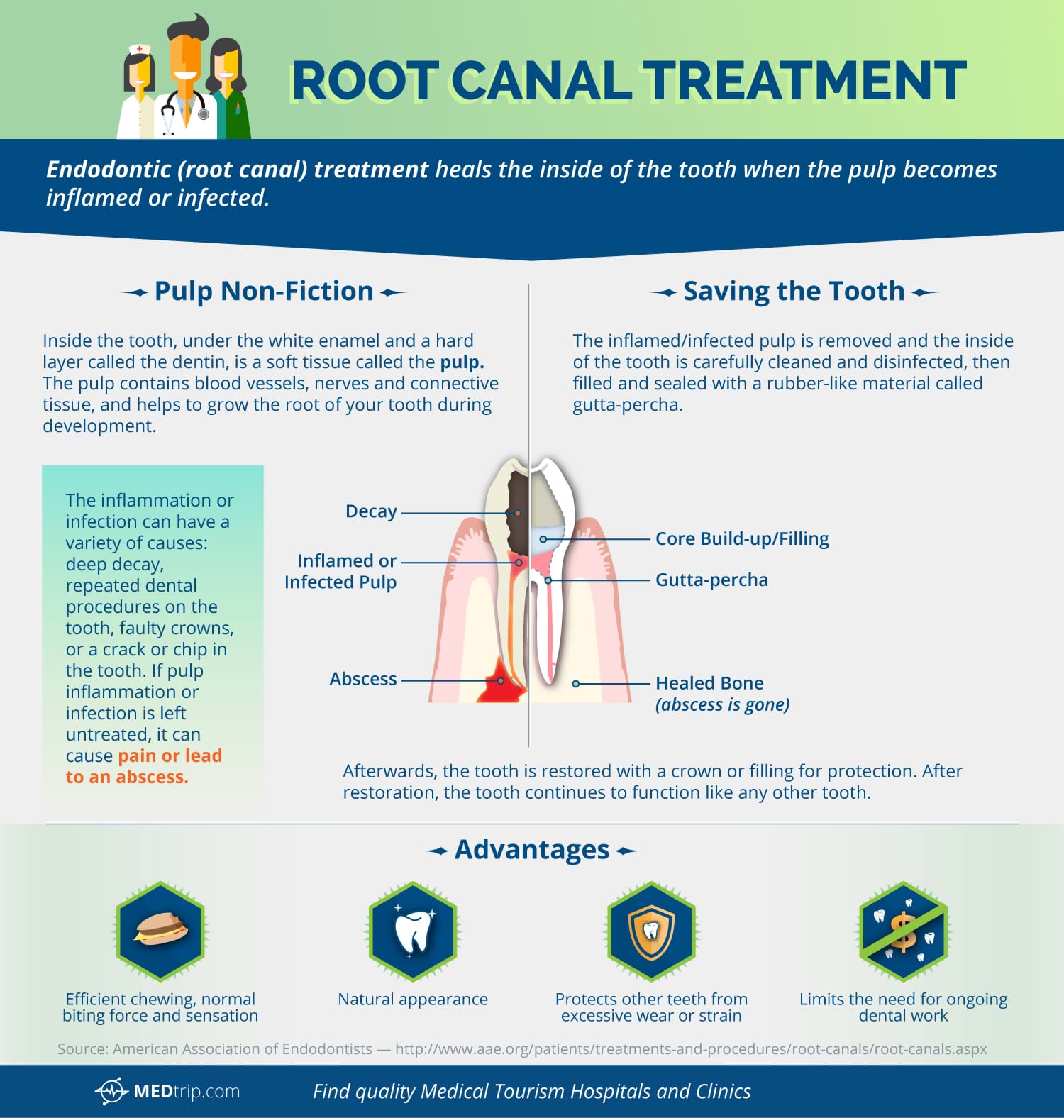 Root Canal